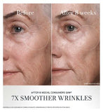 Fresh Black Tea Advanced Age Renewal Cream 50ml