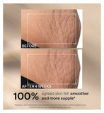 StriVectin SD Advanced PLUS Intensive Moisturizer