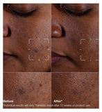 Clinique Even Better Clinical™ Dark Spot Clearing Serum 50ml