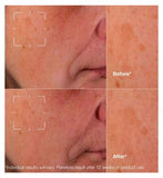 Clinique Even Better Clinical™ Dark Spot Clearing Serum 75ml