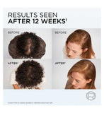 L'Oréal Elvive Growth Booster Shampoo 200ml