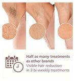 Philips Lumea 9900 Series, IPL Hair Removal Device with SkinAI Technology, 4 Attachments, Corded & Cordless Use, BRI951/01