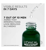 L'Oréal Men Expert Derma Control Anti-Blemish Serum 30ml