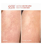 First Aid Beauty KP Bump Eraser Body Scrub With 10% AHA Fresh Peach 226g