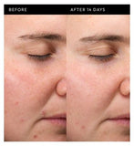 The Inkey List Exosome Hydro-Glow Complex 30ml