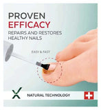 PODERM Fungal Nails Booster Serum (6ml) Regenerates And Accelerates Treatment Of Stubborn Fungal Nails