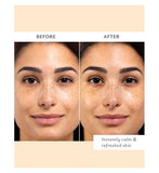 Patchology Skin Remedy Calm & Protect Mist 80ml