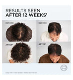 L'Oreal Paris Elvive Growth Booster Shampoo & Serum Bundle