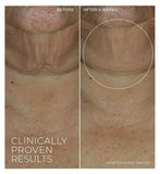 RoC Derm Correxion Retinol Firming Serum Stick to Lift, Tighten & Smooth Fine Lines 30g