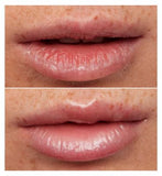 Wonderskin Lip Rehab Serum Oil - Clear - 3.6ml