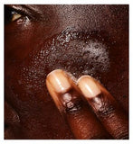 CeraVe Blemish Control Face Cleanser with 2% Salicylic Acid & Niacinamide for Blemish-Prone Skin 473ml