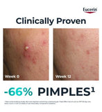 Eucerin DERMOPURE CLINICAL Triple Action Serum 40ml