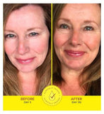 Absolute Collagen Deep Lift Collagen-Boosting Serum, 30ml