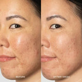 Ole Henriksen Glow2OH Dark Spot Toner 190ml - Brandlistry Nigeria