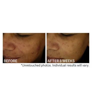 Strivectin Multi - action Clear Daily Brightening & Retexturizing Toner 120ml - Brandlistry Nigeria