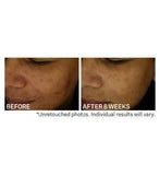 Strivectin Multi - action Clear Daily Brightening & Retexturizing Toner 120ml - Brandlistry Nigeria