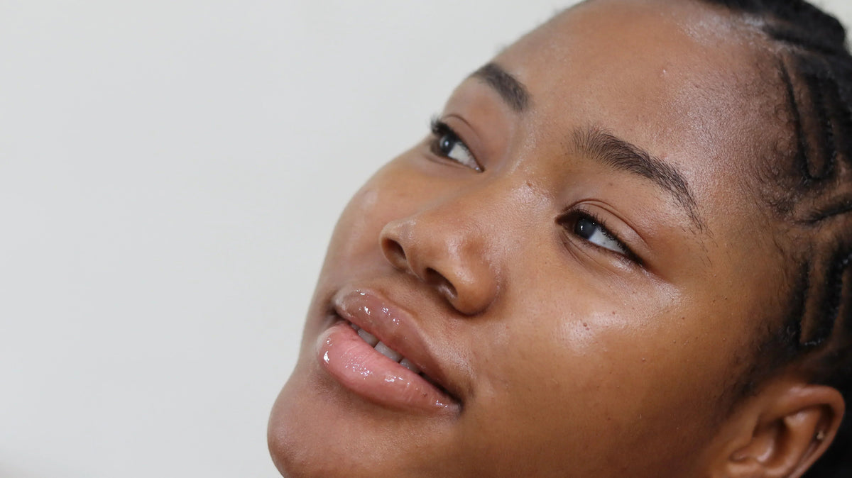 Hyperpigmentation 101: How to Fade Dark Spots Using Only Niche, Safe Ingredients - Brandlistry Nigeria