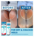 Flexitol Rescue Heel Balm 56g