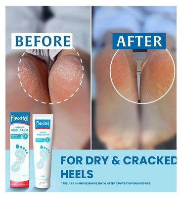 Flexitol Rescue Heel Balm 112g