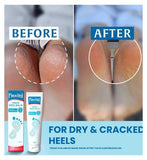 Flexitol Rescue Heel Balm 112g