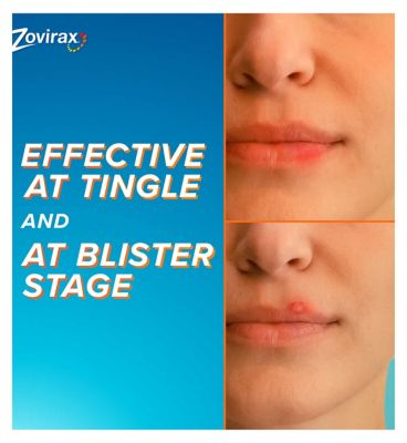 Zovirax Cold Sore Cream Aciclovir Pump 2g