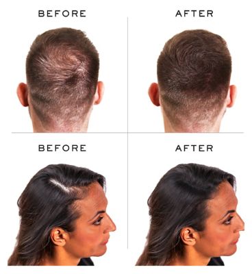 Nanogen Hair Thickening Keratin Fibres -  Medium Brown 30g (2 month supply)