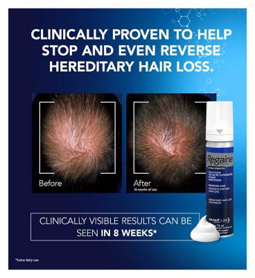 Regaine for Men Extra Strength Scalp Foam 5% w/w Cutaneous Foam - 1 months supply