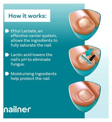 Nailner 2 in 1 Fungal Nail Treatment Brush - 5ml