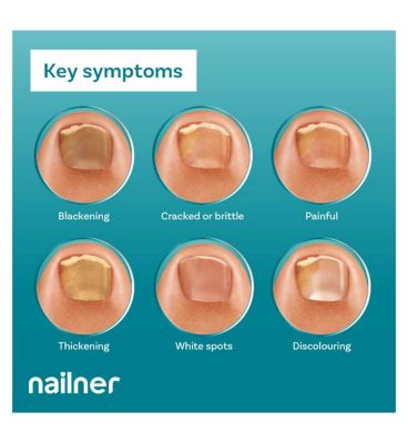 Nailner 2 in 1 Fungal Nail Treatment Brush - 5ml