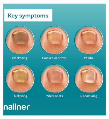 Nailner Anti Fungal Nail Treatment Brush  - 5ml