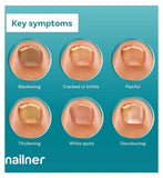 Nailner Anti Fungal Nail Treatment Brush  - 5ml