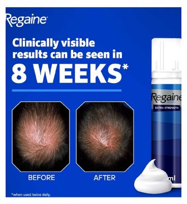 Regaine for Men Extra Strength Scalp Foam 5% w/w Cutaneous Foam - 12 months supply