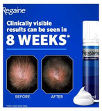 Regaine for Men Extra Strength Scalp Foam 5% w/w Cutaneous Foam - 12 months supply