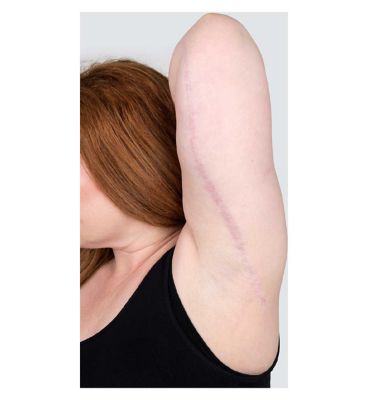 Kelo-Cote Scar Treatment Gel – 15g – Clinically proven advanced silicone formula