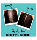 L’Oreal Paris Magic Retouch Dark Brown Root Touch Up, Temporary Instant  Root Concealer Spray With Easy Application, 75ml