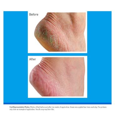 O'Keeffe's Healthy Feet Foot Cream 80ml