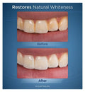 Waterpik Whitening Water Flosser WF-06UK