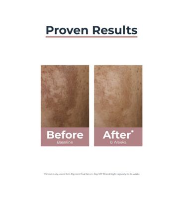 Eucerin Anti-Pigment Face Cream with SPF 30 for Pigmentation & Dark Spots with Thiamidol 50ml