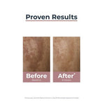 Eucerin Anti-Pigment Face Cream with SPF 30 for Pigmentation & Dark Spots with Thiamidol 50ml