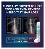 Regaine For Women Once a Day Scalp Foam 5% w/w Cutaneous Foam - 4 Month Supply