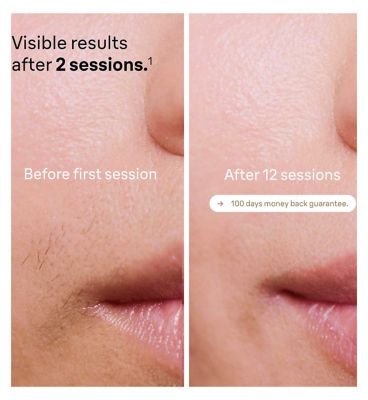 Braun IPL Silk-Expert Pro 5, At Home Hair Removal Device with Pouch, White/Gold, PL5124