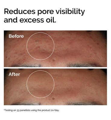 The Ordinary Niacinamide 10% + Zinc 1% Oil Control Serum - 30ml