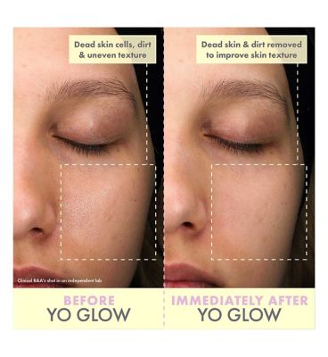 WISHFUL Yo Glow AHA & BHA Facial Enzyme Scrub 100ml