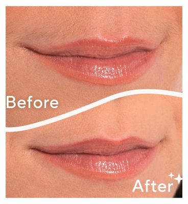 Finishing Touch Flawless Face, Facial Hair Remover for Women