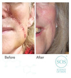 Science of Skin Solution for Scars 30ml