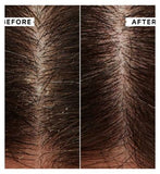 Philip Kingsley Flaky/Itchy Scalp Mask 20ml x 2