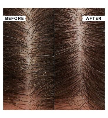 Philip Kingsley Flaky/Itchy Scalp Toner 250ml