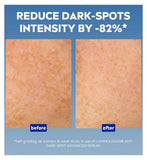 NIVEA Cellular Luminous 630 Anti-Dark Spot Face Serum, 30ml