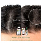 Klorane Strengthening Shampoo with Quinine and Organic Edelweiss for Thinning Hair 200ml