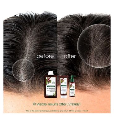 Klorane Strengthening Conditioner with Quinine and Organic Edelweiss for Thinning Hair 200ml